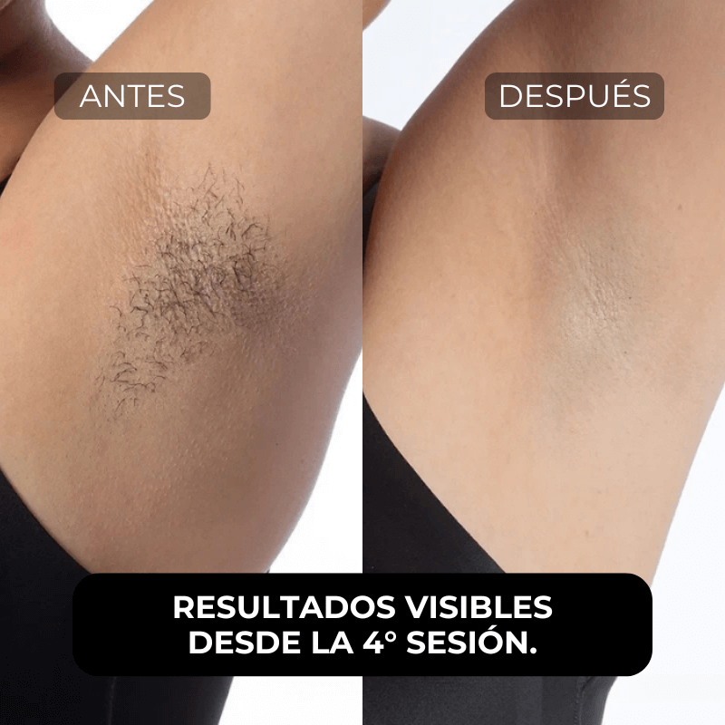 Depiladora Definitiva Skin Mood