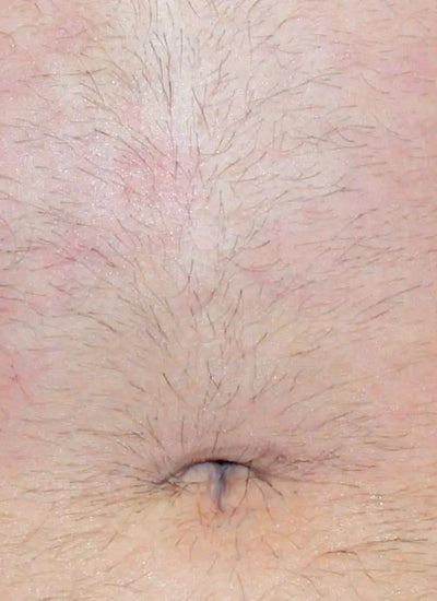 Antes